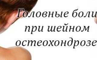 Боли в голове при остеохондрозе