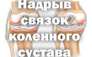 Внутренняя связка коленного сустава