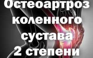 Остеоартроз колена