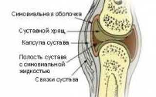 Разрушение суставов