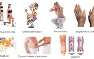 Препараты при артрозе