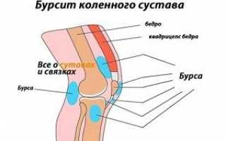 Коленный бурсит лечение