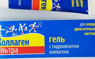 Профилактика суставов и связок